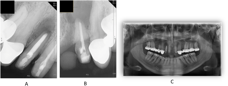 Fig. 13