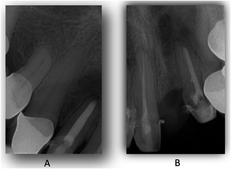 Fig. 15