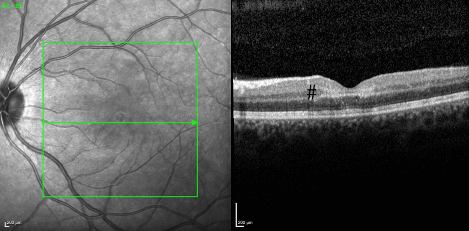 Fig. 3