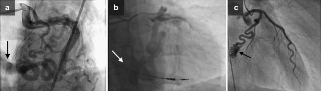 Fig. 1