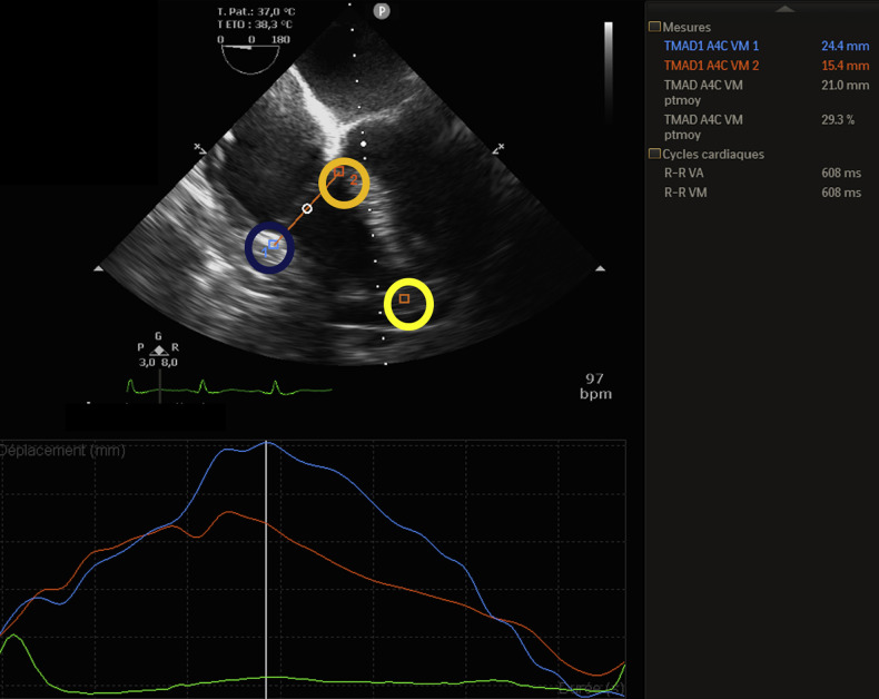 Figure 1