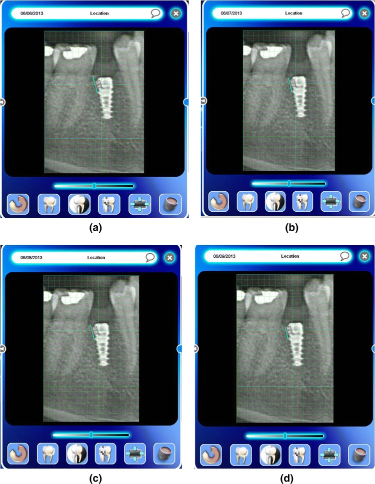 Fig. 10