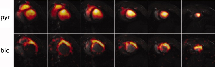 Fig. 13