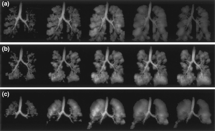 Fig. 12