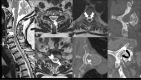 Figure 3 (A-G)