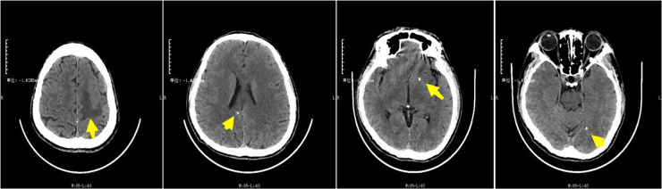 Fig. 1