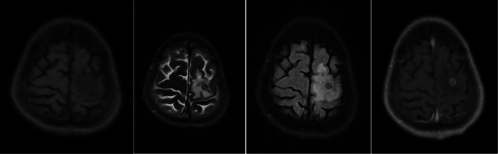 Fig. 2