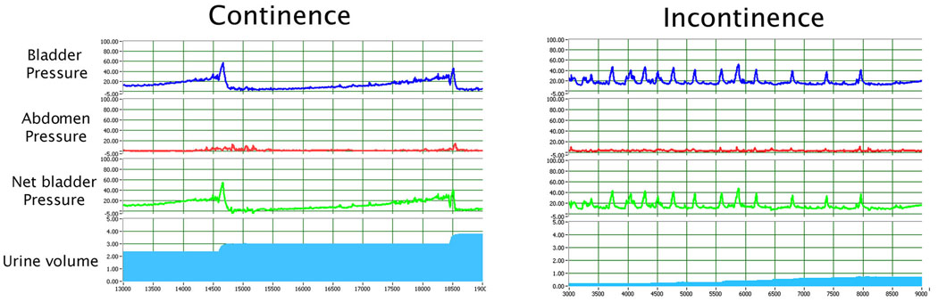 Fig. 2