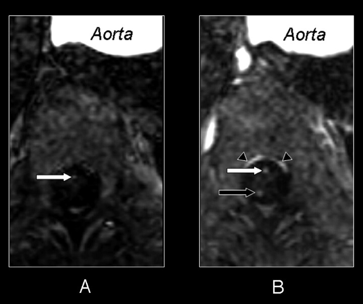 Fig 2.