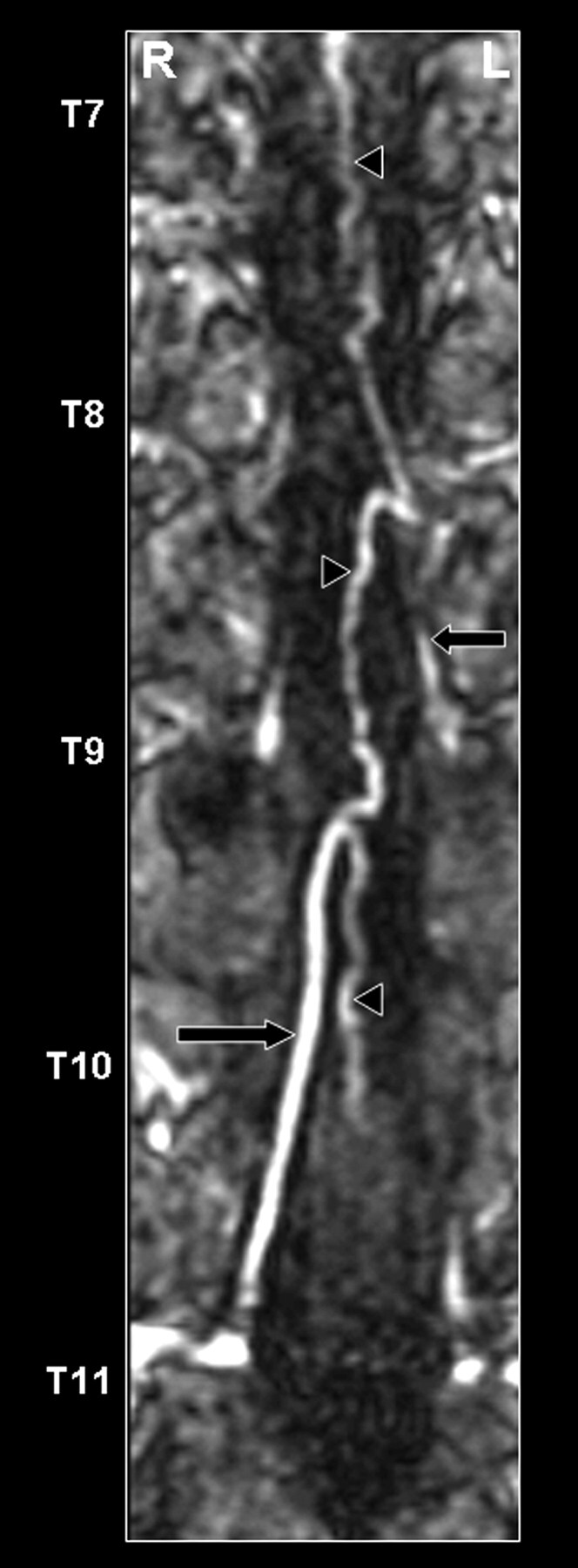 Fig 3.