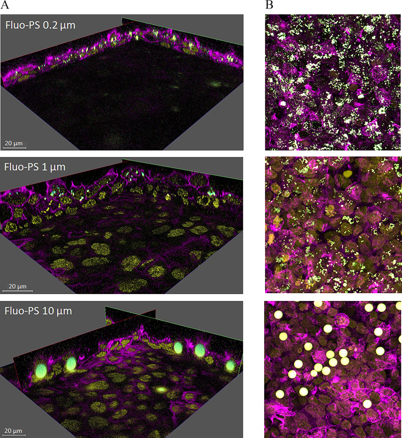 Figures 5A and 5B are set of three three-dimensional videos and three stained tissues, depicting the internalization of fluorescent polystyrene particles in non-syncytialized cells with an exposure of 0.2 micrometer, 1 micrometer, and 10 micrometers, respectively, for nucleus and lowercase beta actin.