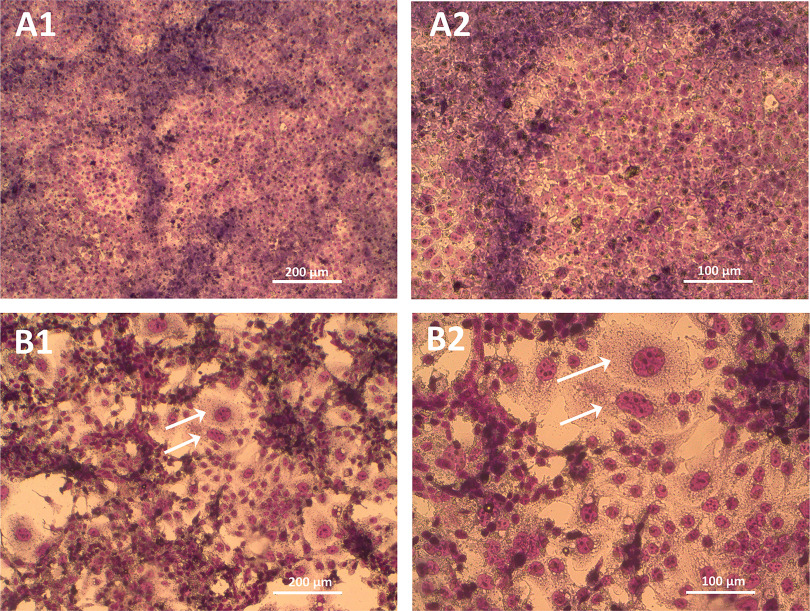 Figure 3 is a set of four stained tissues titled A 1, A 2, B 1, and B 2 depicting the morphology of the non-syncytialized and syncytialized cells. A 1 and B 1 are induced with 200 micrometers of forskolin during treatment, and A 2 and B 2 are induced with 100 micrometers of forskolin during treatment. The arrows indicate multi-nucleated cells formed after syncytialization.