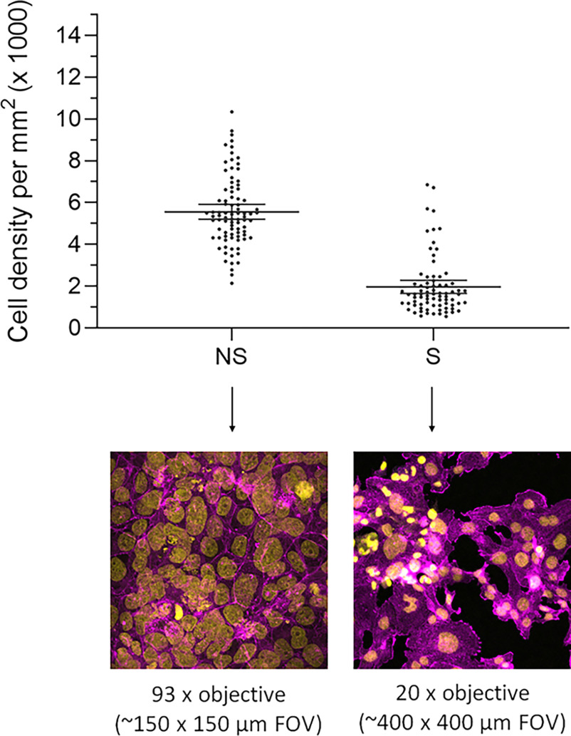 Figure 4 is a set of one dot plot and two stained tissues. The dot plot, plotting cell density per millimeter squared (times 1000), ranging from 0 to 14 in increments of 2 (y-axis) across non-syncytialized and syncytialized (x-axis). The two stained tissues were labeled 93 times objective (approximately 150 times 150 micrometers field of view) and 20 times objective (approximately 400 times 400 micrometers field of view), depicting the cell density based on 4′,6-diamidino-2-phenylindole and SiR-actin staining.