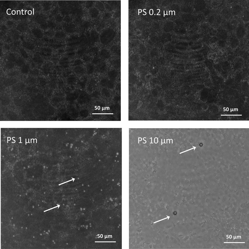 Figure 6 is a set of four stained tissues titled control, pristine polystyrene particles at 0.2 micrometer, pristine polystyrene particles at 1 micrometer, and pristine polystyrene particles at 10 micrometers in non-syncytialized cells with an exposure of 50 micrometers.