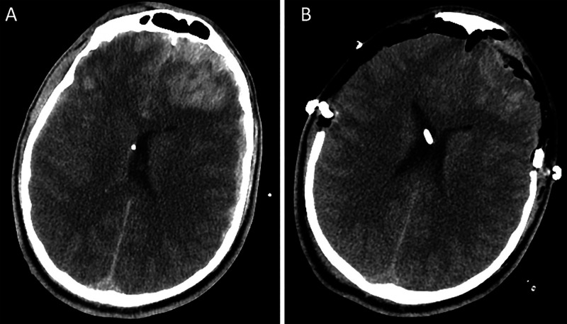 FIG. 2.