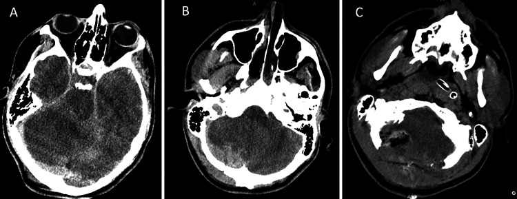 FIG. 1.