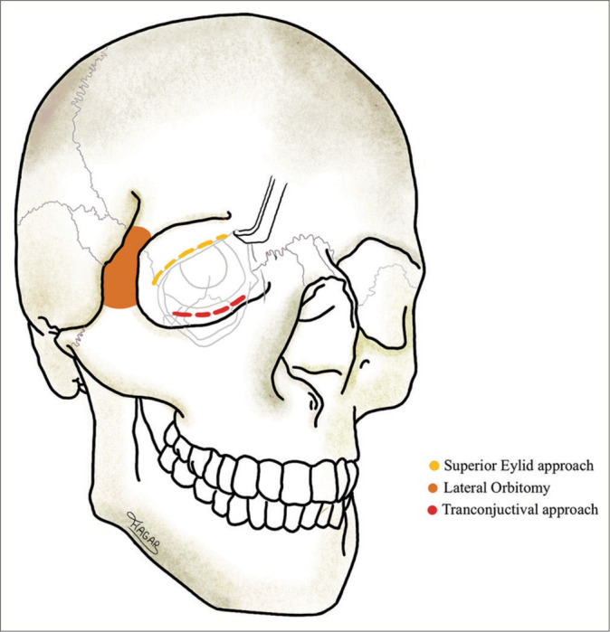 Figure 1: