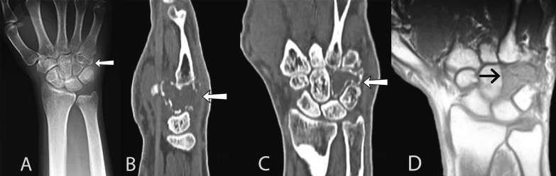 Fig. 1