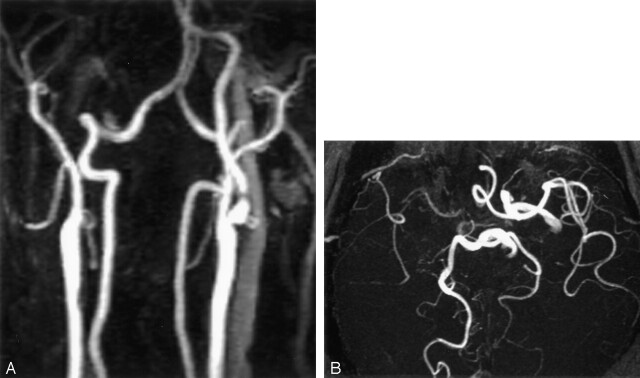 Fig 2.