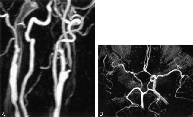 Fig 3.