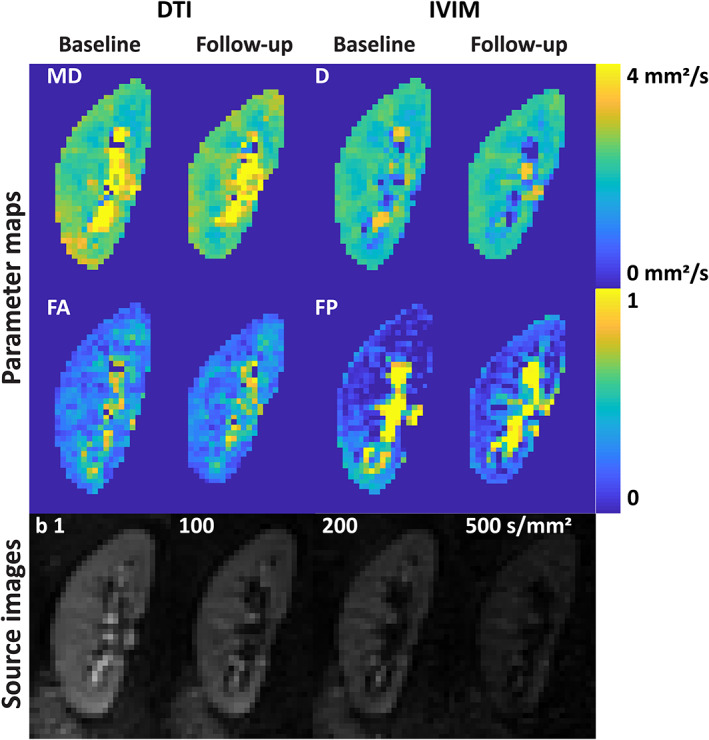 FIGURE 3