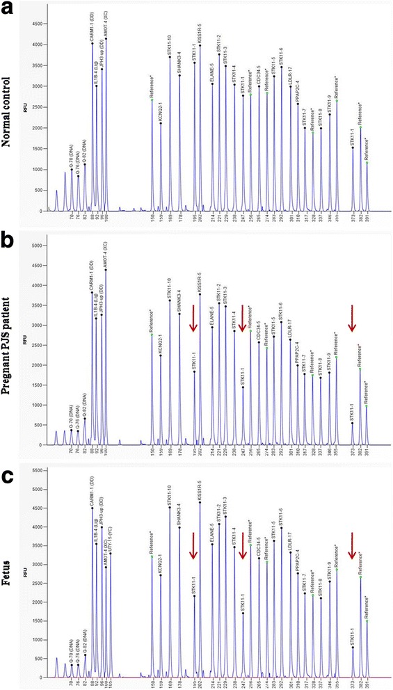 Fig. 3