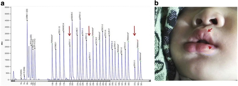 Fig. 4