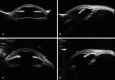 Fig. 1A to D:
