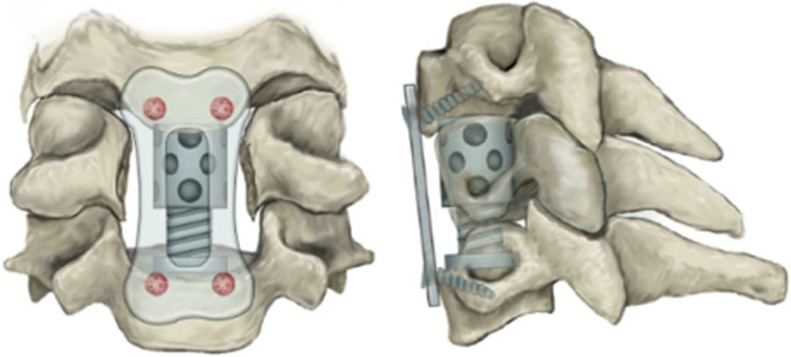 Fig. 2