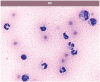 Figure 16a