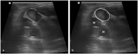 Figure 22