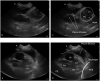 Figure 27