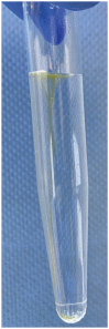 Figure 17