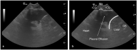 Figure 25