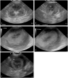 Figure 23
