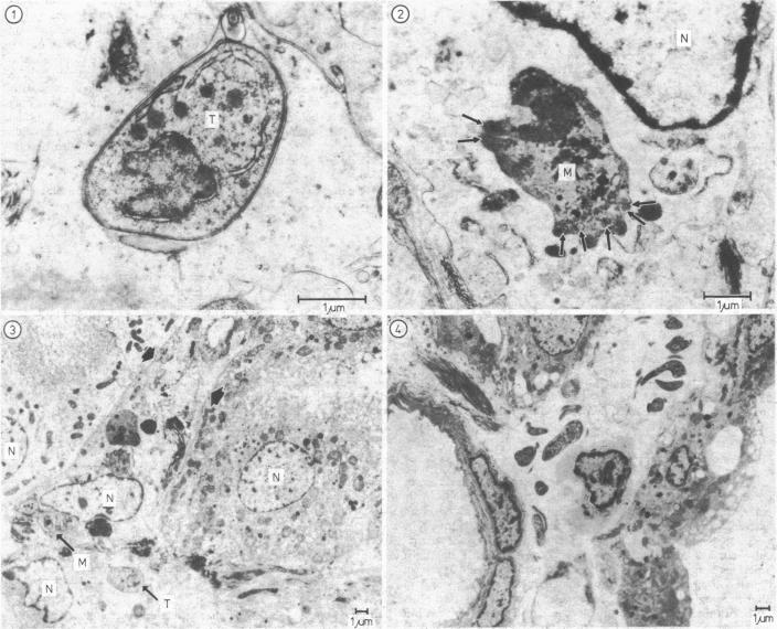 FIGS 1-4