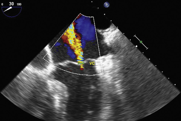 Fig 1.