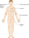 Figure 3.2