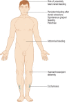 Figure 3.17