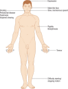 Figure 3.32