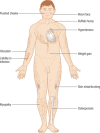 Figure 3.11