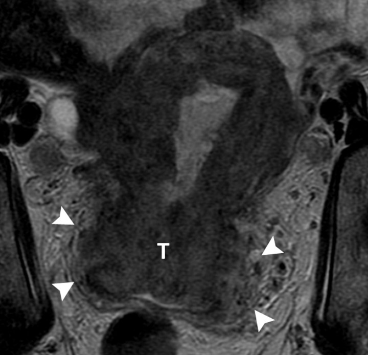 Figure 4b: