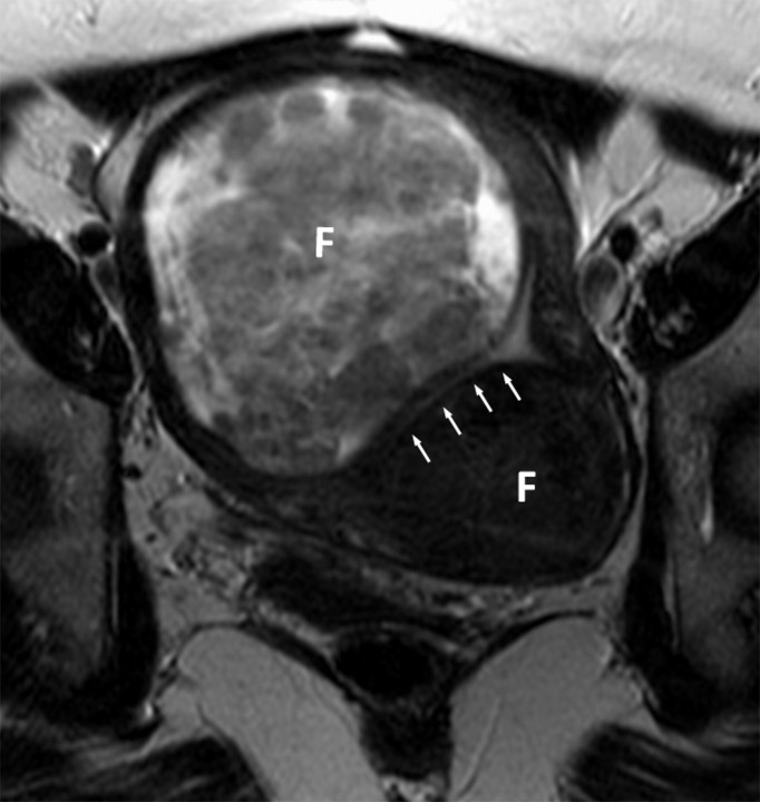 Figure 1a: