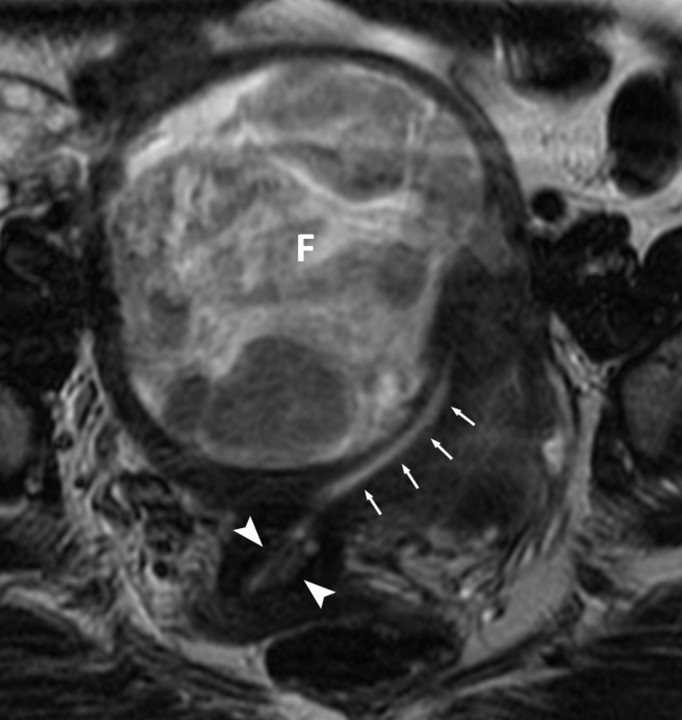 Figure 1b: