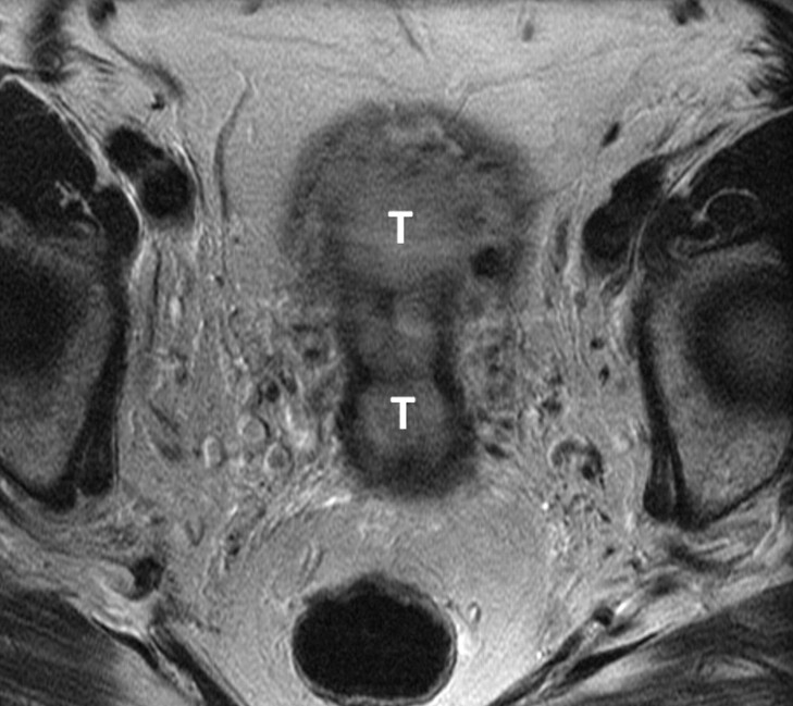 Figure 3b: