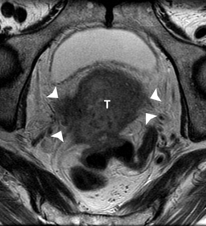 Figure 4a: