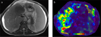 Figure 10. a, b