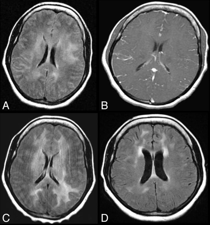 Fig 6.