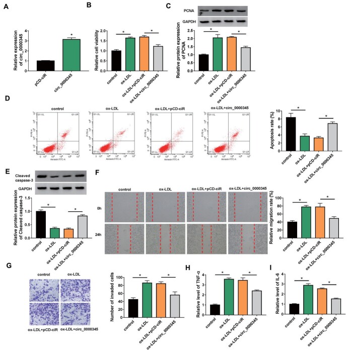 Fig.3. Effects of circ_0000345 overexpression on ox-LDL-induced ASMC proliferation, migration, invasion, and inflammatory response