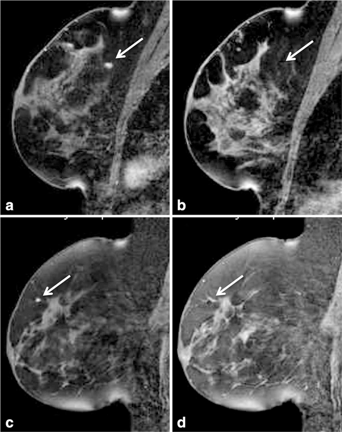 Figure 16.